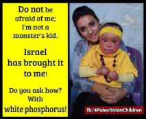 how jews mangle children faces and lives with hot white phosphorus 32411103_116990189176281_1101205580057411584_n